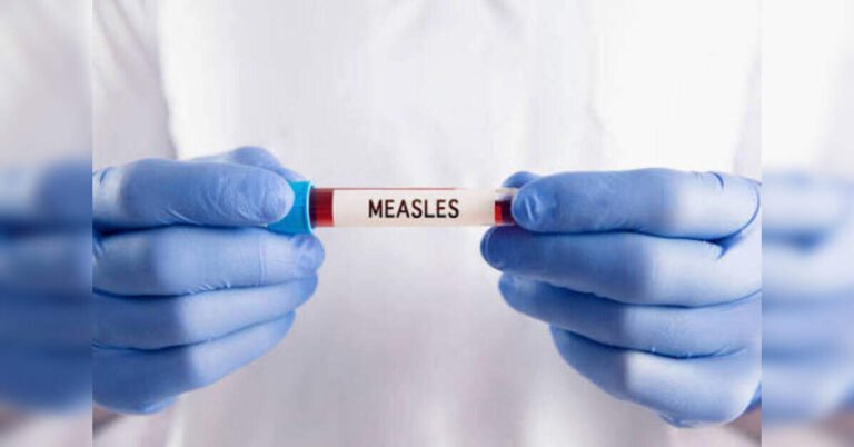 us-measles-cases-rise-to-4,080,-cdc-says