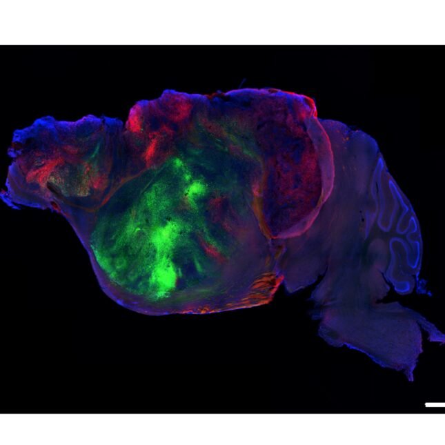 STAT+: Scientists made mice with half a brain. Then they filled them with human organoids