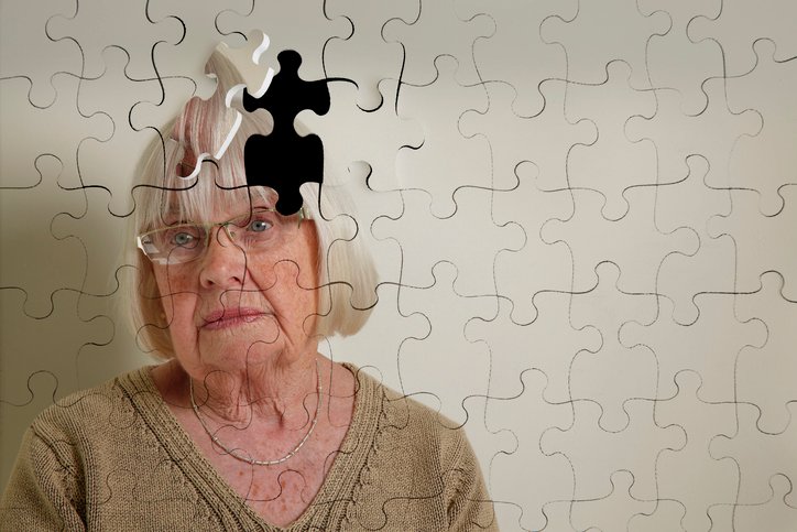 AI Can Flag Cognitive Decline Earlier — Health Systems Still Own What Happens Next
