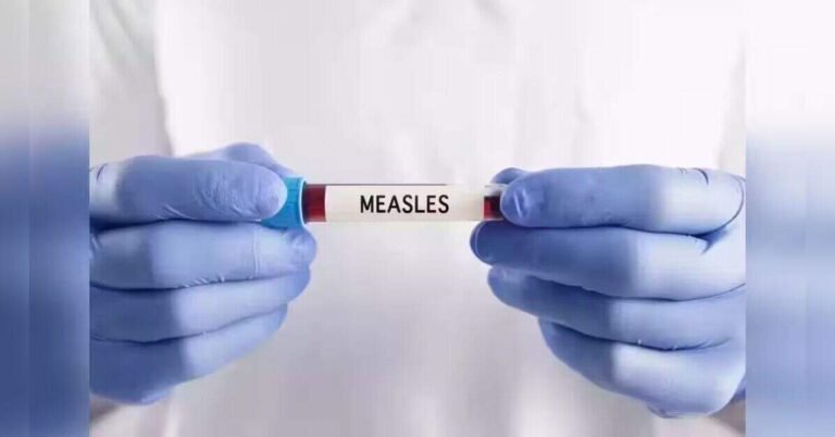 pennsylvania-measles-death-toll-rises-to-six-after-franklin-county-fatality