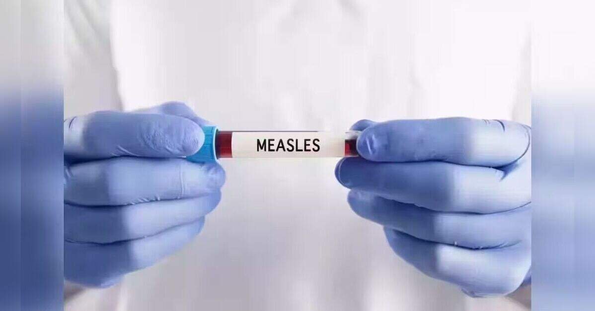 Pennsylvania measles death toll rises to six after Franklin County fatality