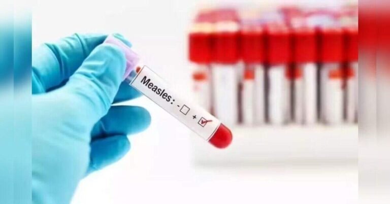 cdc-to-deploy-additional-support-to-pennsylvania-to-probe-measles-outbreak