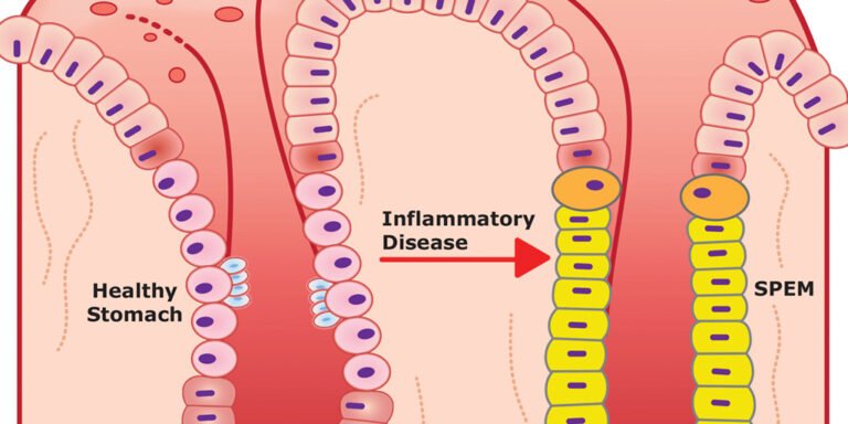 male-hormones-regulate-stomach-inflammation-in-mice