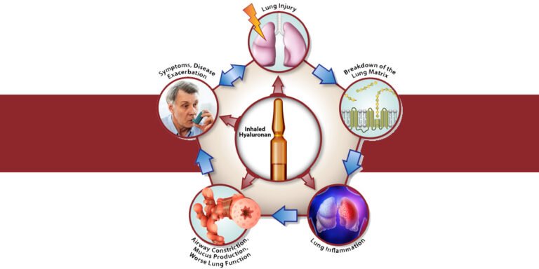 nih-study-shows-hyaluronan-is-effective-in-treating-chronic-lung-disease