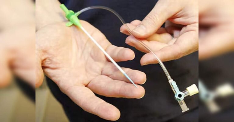 health-ministry-asked-to-examine-coronary-stent-safety-concerns