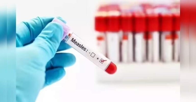 pennsylvania-reports-1,222-measles-cases-as-outbreak-grows