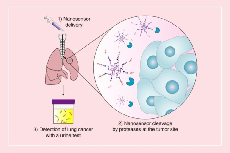 new-sensors-could-offer-early-detection-of-lung-tumors